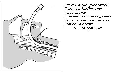 Рисунок 4